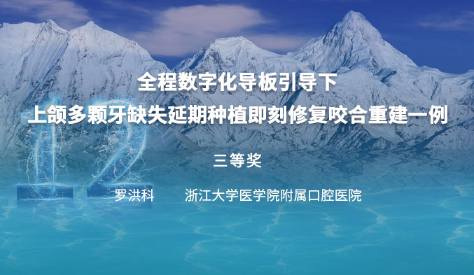 全程数字化导板引导下上颌多颗牙缺失延期种植即刻修复咬合重建一例