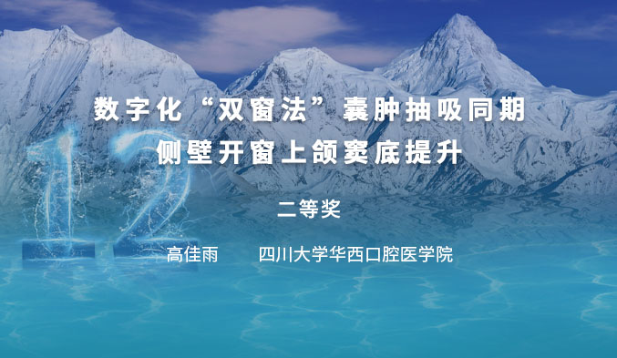 数字化“双窗法”囊肿抽吸同期侧壁开窗上颌窦底提升