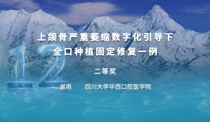 数字化引导下上颌骨严重萎缩全口种固定修复一例