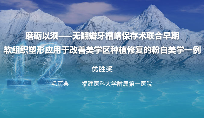 磨砺以须——无翻瓣牙槽嵴保存术联合早期软组织塑形应用于改善美学区种植修复的粉白美学一例