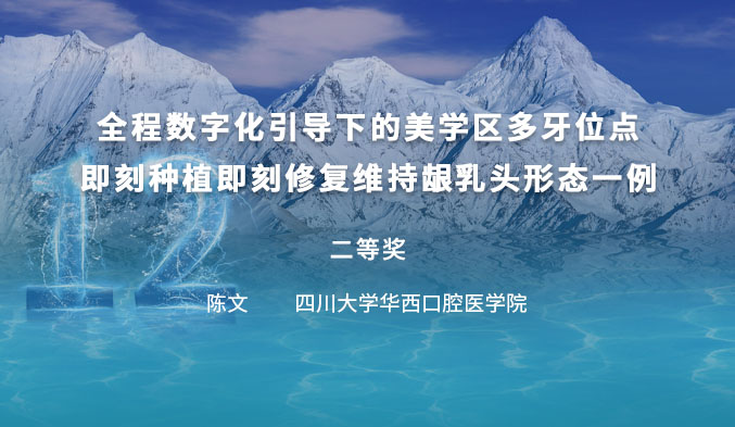 全程数字化引导下美学区连续缺失即刻种植即刻修复一例