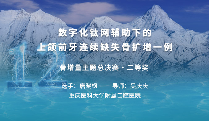 数字化钛网辅助下的上颌前牙连续缺失骨扩增一例