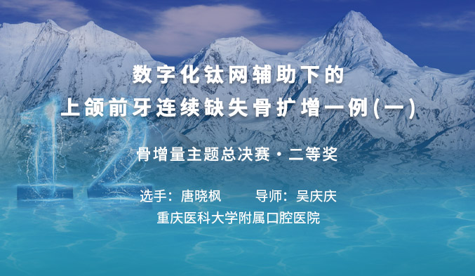 数字化钛网辅助下的上颌前牙连续缺失骨扩增一例（一）