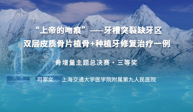 “上帝的吻痕”——牙槽突裂缺牙区双层皮质骨片植骨+种植牙修复治疗一例