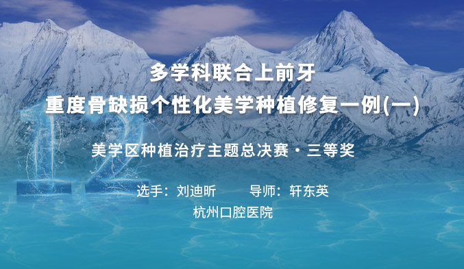 多学科联合上前牙重度骨缺损个性化美学种植修复一例（一）
