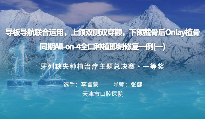 导板导航联合运用，上颌双侧双穿颧，下颌截骨后Onlay植骨，同期All-on-4全口种植即刻修复一例（一）
