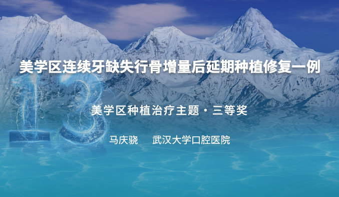 美学区连续牙缺失行骨增量后延期种植修复一例