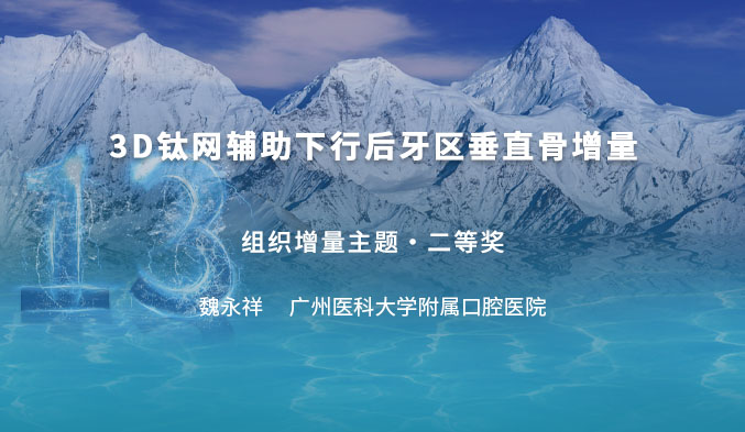 3D钛网辅助下行后牙区垂直骨增量