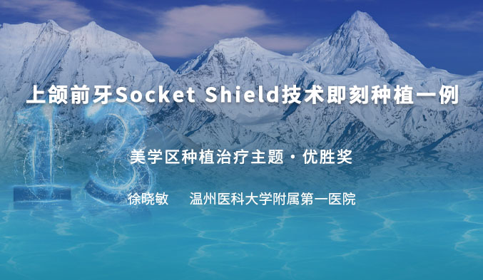 上颌前牙Socket Shield技术即刻种植一例