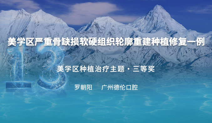 美学区严重骨缺损软硬组织轮廓重建种植修复一例