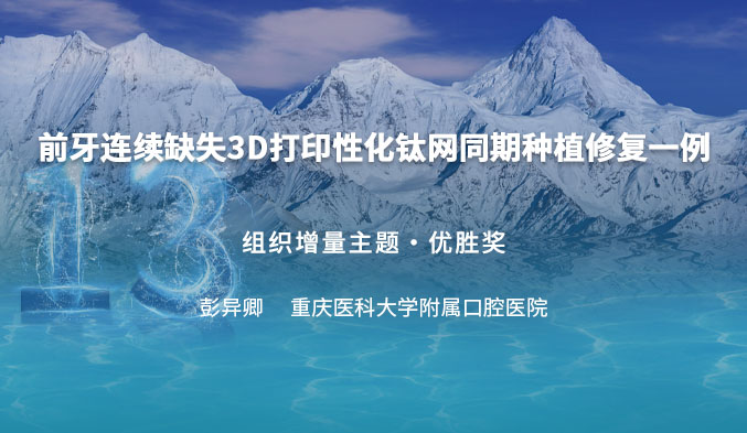 前牙连续缺失3D打印性化钛网同期种植修复一例
