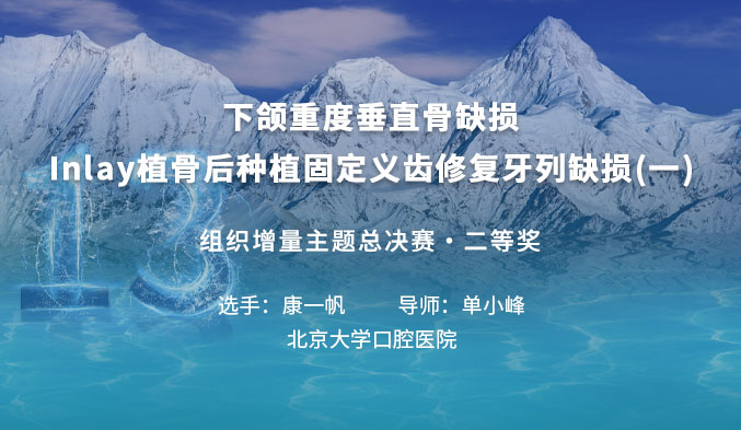 下颌重度垂直骨缺损Inlay植骨后种植固定义齿修复牙列缺损（一）