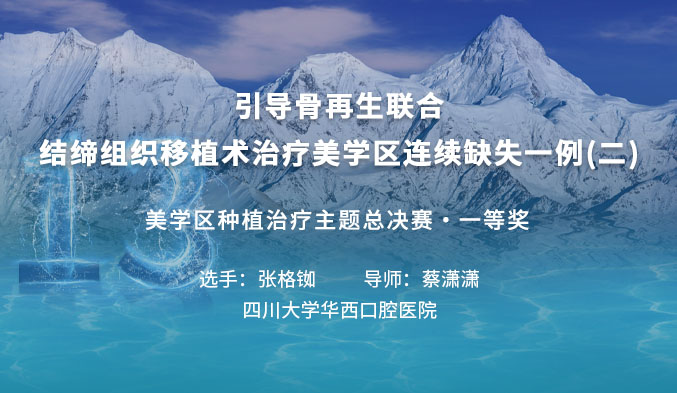 引导骨再生联合结缔组织移植术治疗美学区连续缺失一例（二）