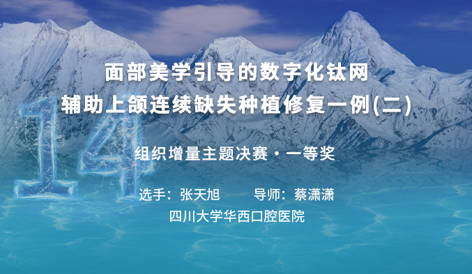 面部美学引导的数字化钛网辅助上颌连续缺失种植修复1例（二）