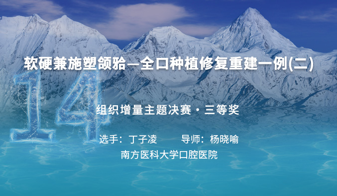 软硬兼施塑颌𬌗—全口种植修复重建一例（二）