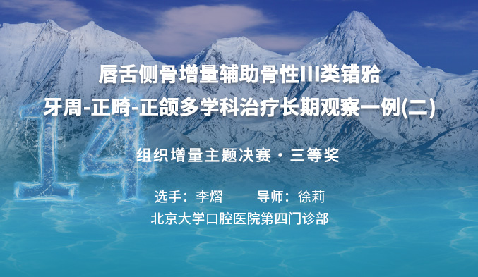 唇舌侧骨增量辅助骨性III类错𬌗 牙周-正畸-正颌多学科治疗长期观察一例（二）