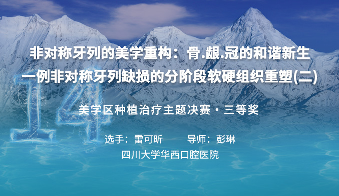 非对称牙列的美学重构：骨.龈.冠的和谐新生 —— 一例非对称牙列缺损的分阶段软硬组织重塑（二）