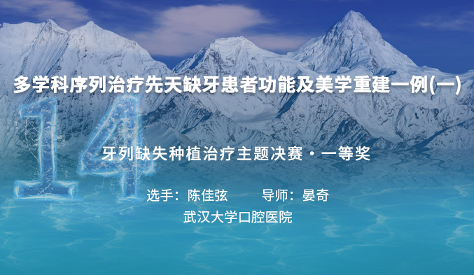 多学科序列治疗先天缺牙患者功能及美学重建一例（一）