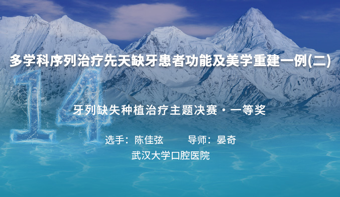多学科序列治疗先天缺牙患者功能及美学重建一例（二）
